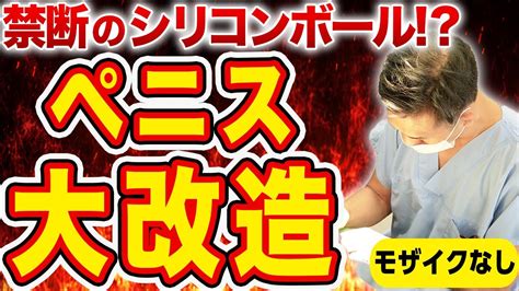 改造チンポとは|シリコンボールの効果・効果的な位置 – メンズ形成外。